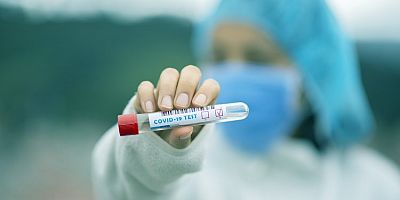 KRV’de test sonucu getirenler karantinaya tabi tutulmayacak